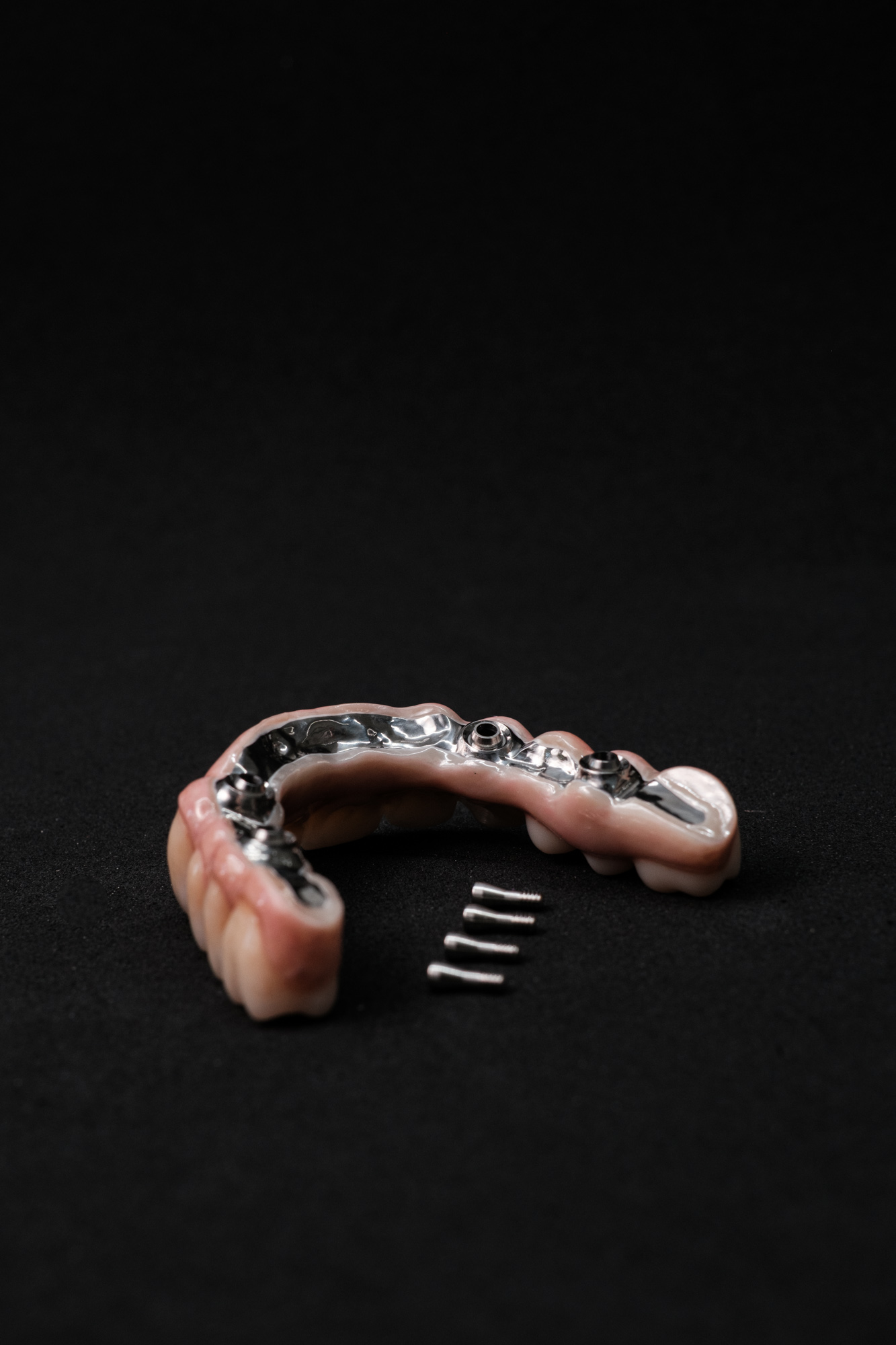 Vollzirkonarbeit auf Implantate okklusal verschraubt