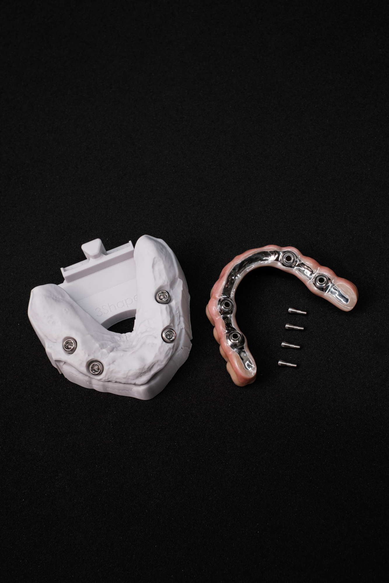 Vollzirkonarbeit auf Implantate okklusal verschraubt