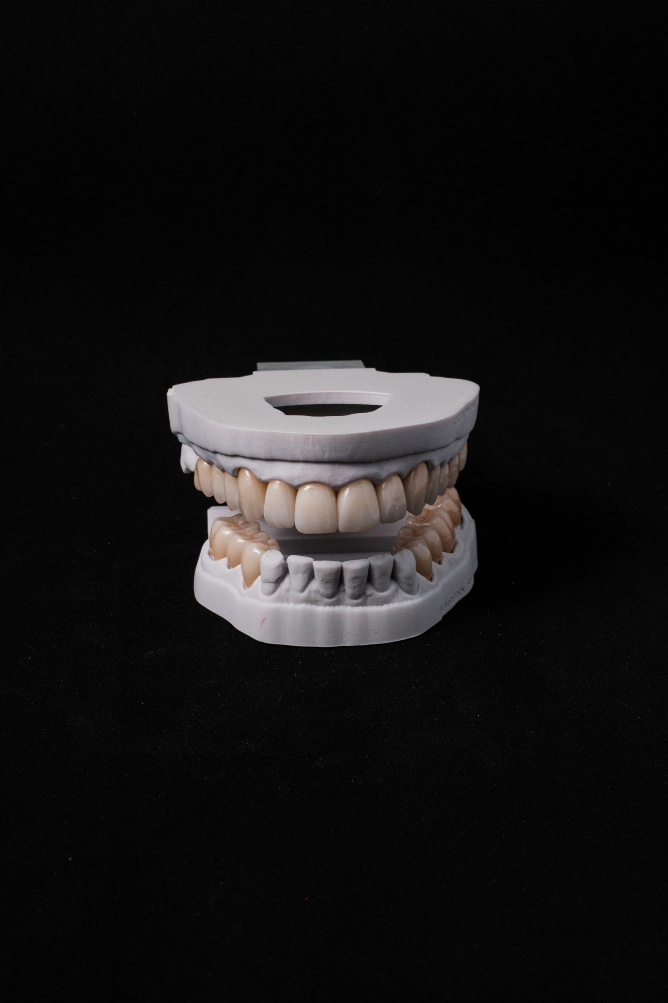 Vollzirkon Kronen und Bruecken