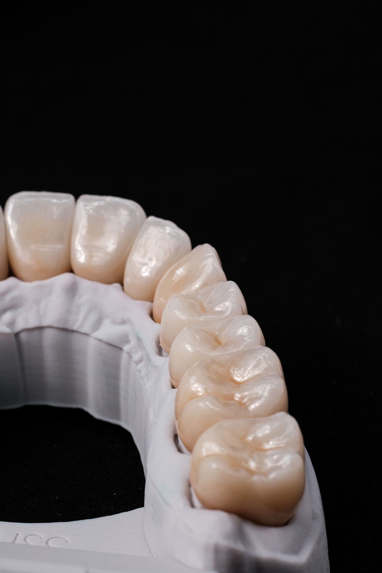 Vollzirkon Kronen und Bruecken