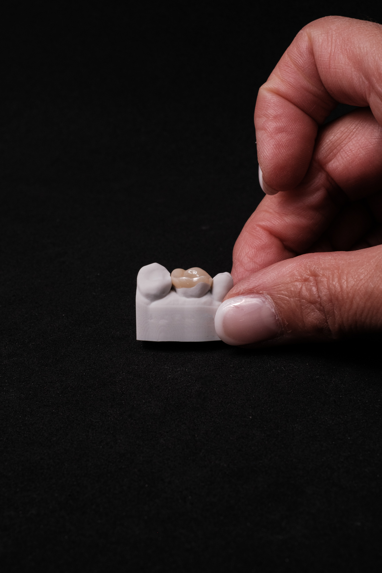 Vollzirkon Teilkrone