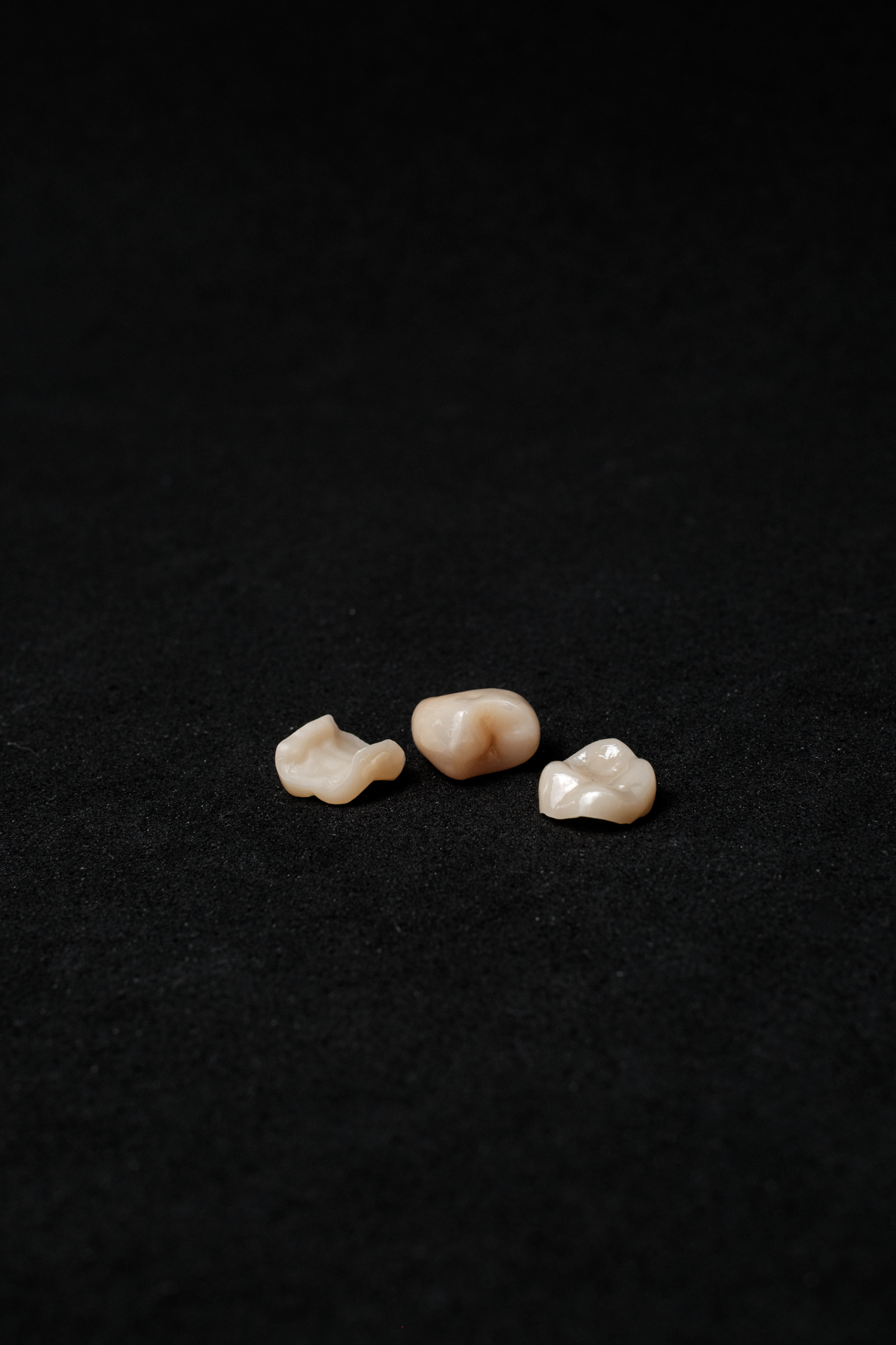 Vollzirkon Kronen und Teilkronen